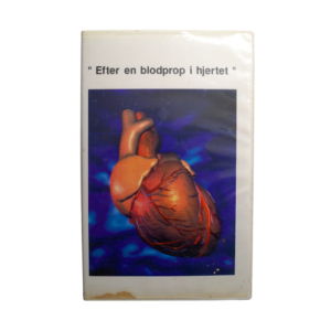 Efter en blodprop i hjertet – Rigshospitalet & Hjerteforeningen – VHS (Brugt)